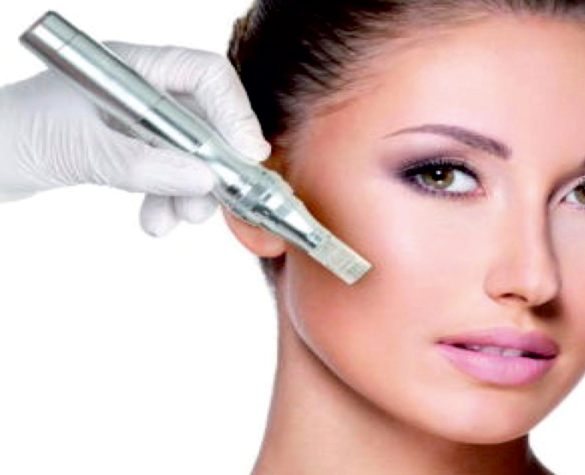 Microneedling